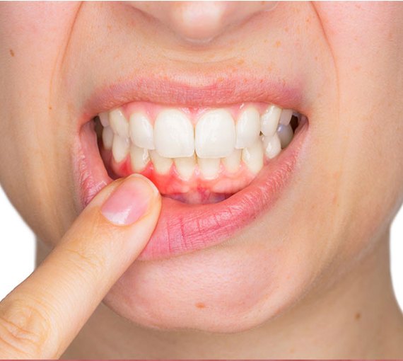 Periodontology